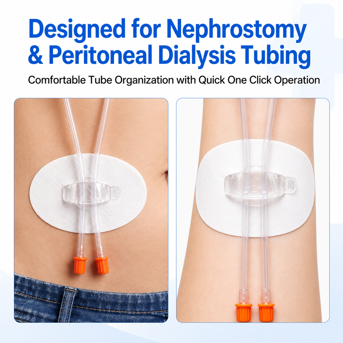 Tube Fixation Patches with Dual Channel Clips on 360 Degree Rotating Bases, Breathable Nonwoven Pads with Acrylic Adhesive for Daily Wear, 3 Pack